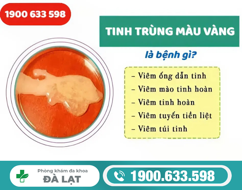 Hình ảnh minh họa